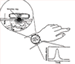 Wristwatch Compliance Monitor